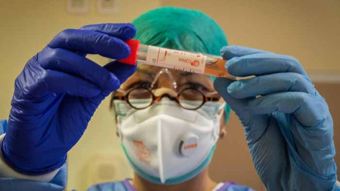 Първи случай на повторна инфекция с коронавирус в света