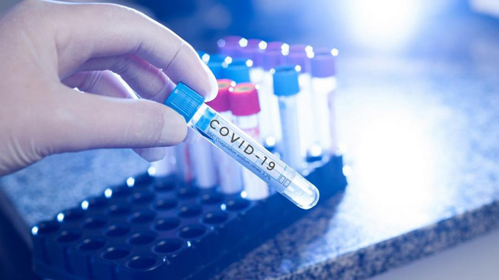 Един починал и 10 нови случая на коронавирус във Варна за изминалото денонощие