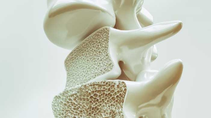 Всеки четвърти е диагностициран с намалена костна плътност или остеопороза