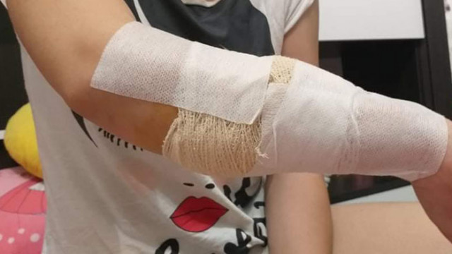 Простреляха дете с въздушна пушка във Варна