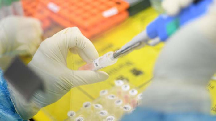 Симптомите на COVID-19 може да продължат над 3 седмици