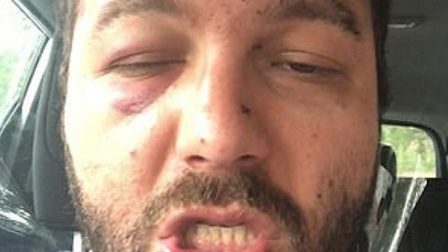 Англичани пребиха български таксиметров шофьор