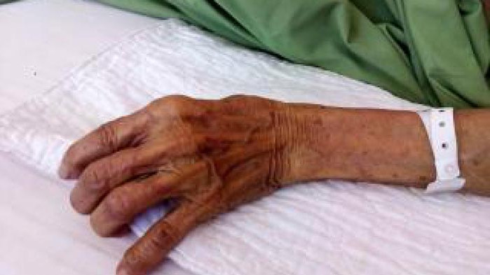 33-годишен варненец е нанесъл жесток побой на 77 годишна жена във Варна