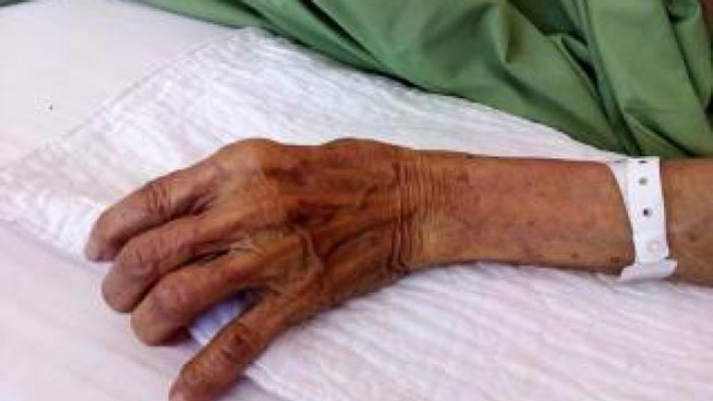 33-годишен варненец е нанесъл жесток побой на 77 годишна жена във Варна