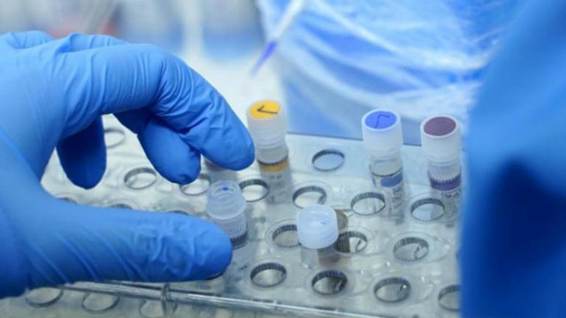 РЗИ: След детско парти има 9 случая с коронавирус във Варна, общо заболелите за деня са 11, а не 12!