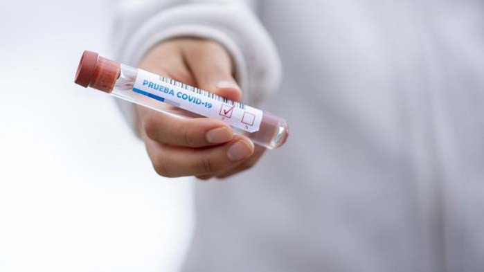 40% от жителите на италиански град асимптоматични носители на коронавирус