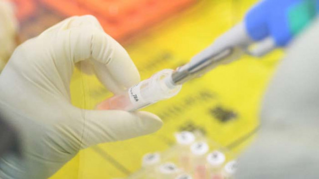 Затварят яслена група във Варна, заради положителна проба за COVID-19 на дете