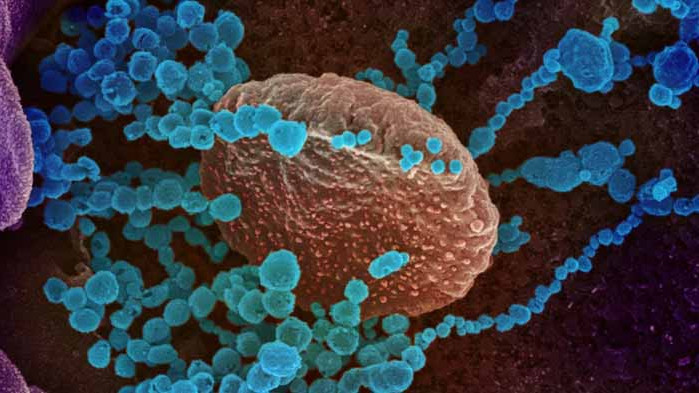 Откриха опасно антитяло в кръвта на хора с тежка форма на COVID-19