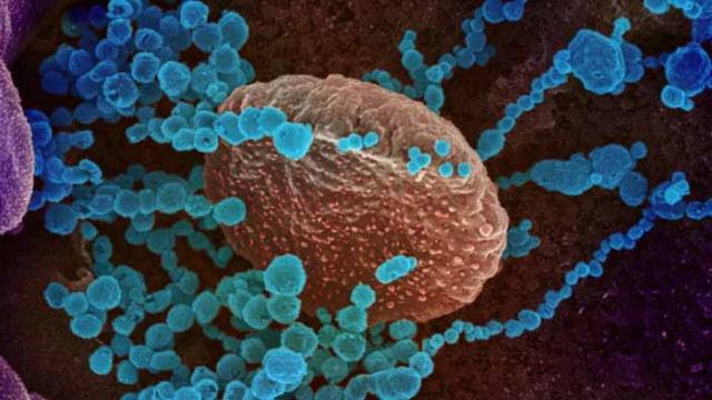 Откриха опасно антитяло в кръвта на хора с тежка форма на COVID-19