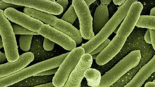 Mладеж почина от бубонна чума