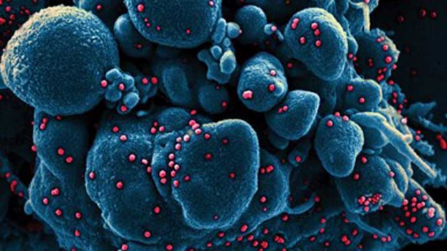 Какво ще стане, ако вирусите изчезнат?