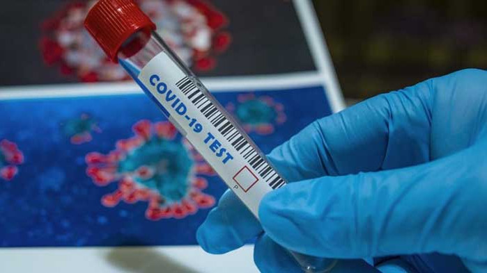 Дете с COVID-19 е развило симптоми, лекуват го лекарите от Инфекциозна клиника на УМБАЛ “Св. Марина“