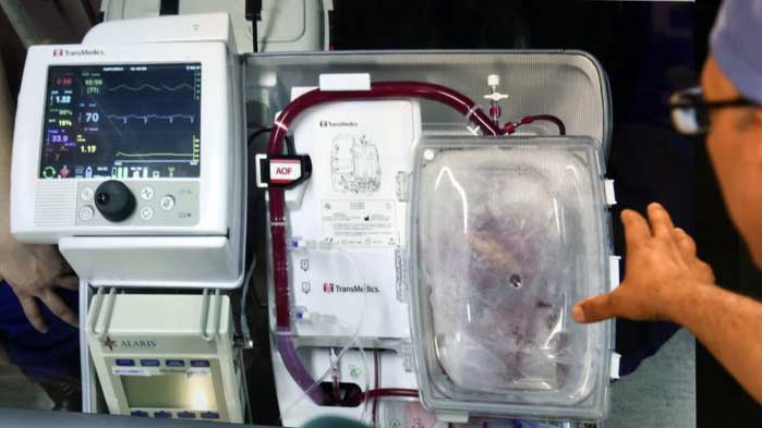 Създадоха първото в света човешко сърце на 3D принтер