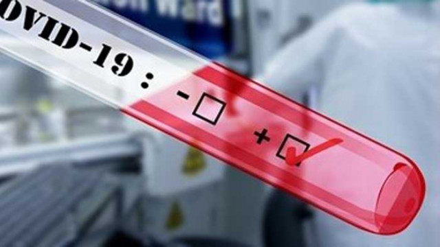 Сърбия с най-много хоспитализирани заради COVID-19 в Западните Балкани