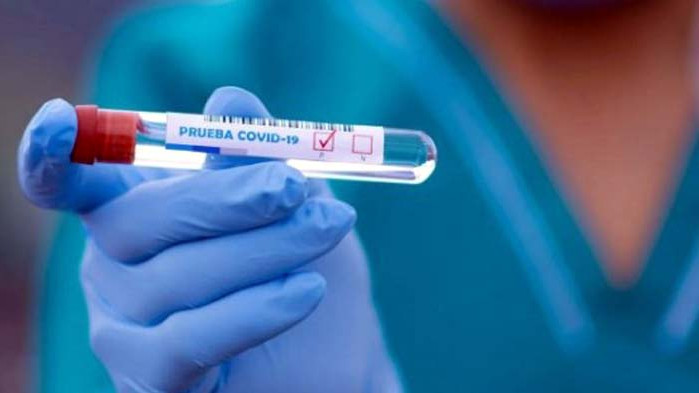 До края на деня ще излязат резултатите от тестовете в Дома за възрастни хора край Варна