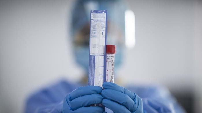 Руски учен изследва невъзприемчивостта към COVID-19